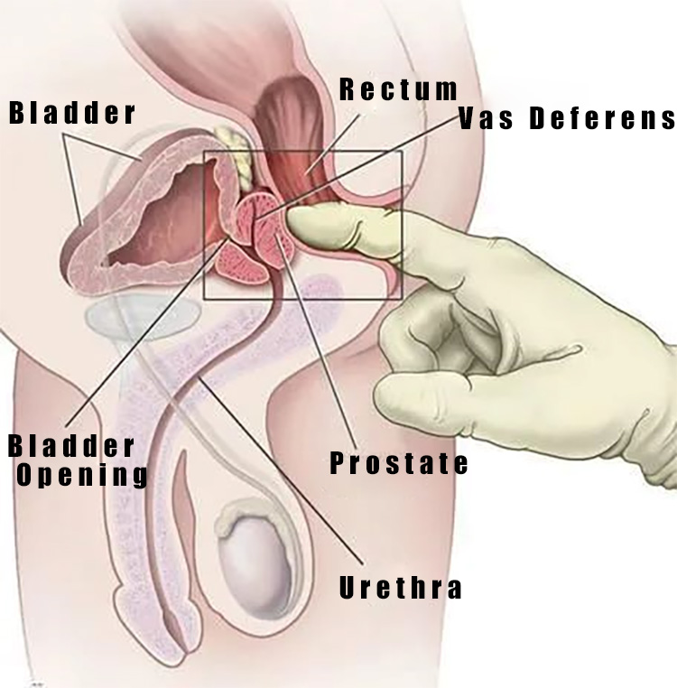 Where is the Prostate.jpg