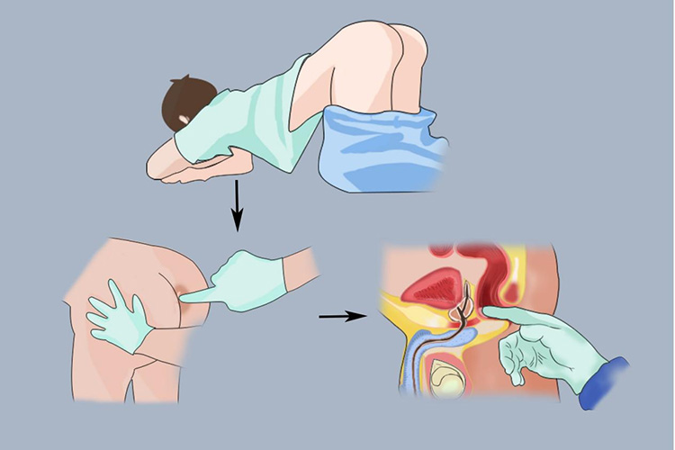 Prostate Massage Demo.jpg