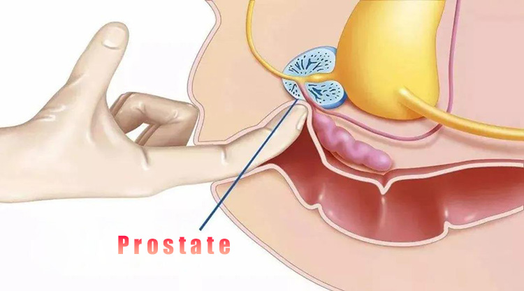 Prostate Health Massage.jpg